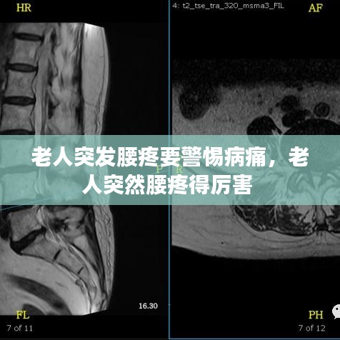 老人突发腰疼要警惕病痛,老人突然腰疼得厉害