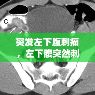 突发左下腹刺痛，左下腹突然刺痛的原因 