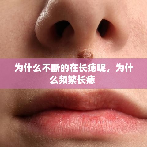 为什么不断的在长痣呢，为什么频繁长痣 