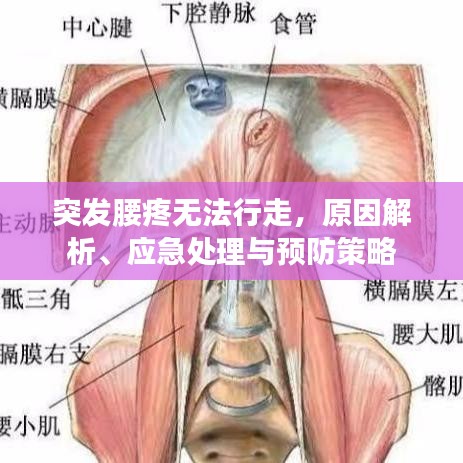 突发腰疼无法行走，原因解析、应急处理与预防策略