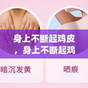 身上不断起鸡皮，身上不断起鸡皮疙瘩痒 