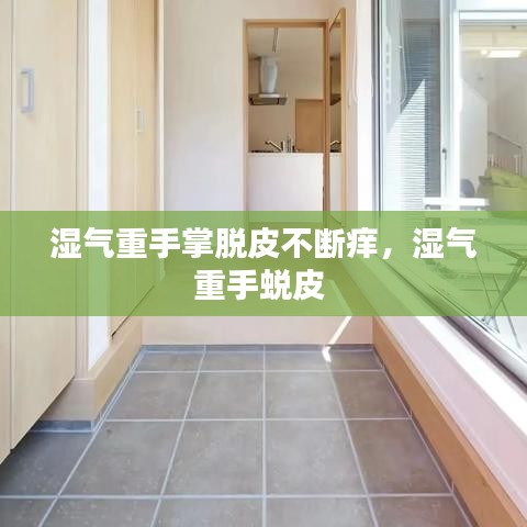 湿气重手掌脱皮不断痒,湿气重手蜕皮