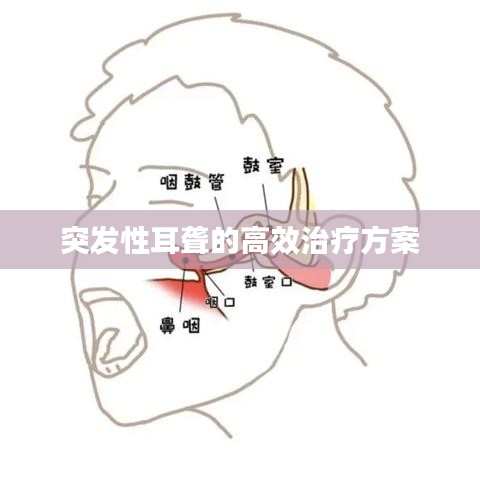 突发性耳聋的高效治疗方案