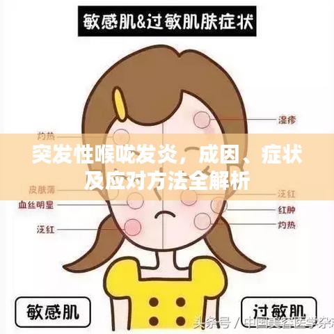 突发性喉咙发炎，成因、症状及应对方法全解析