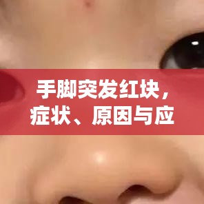 手脚突发红块，症状、原因与应对方法全解析