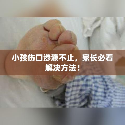 小孩伤口渗液不止，家长必看解决方法！