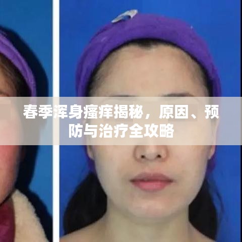 春季浑身瘙痒揭秘，原因、预防与治疗全攻略